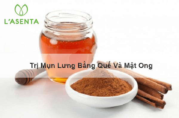 trị mụn lwung tại nahf bằng quế và mật ong